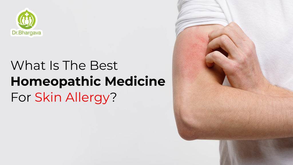 What Is The Best Homeopathic Medicine For Skin Allergy?